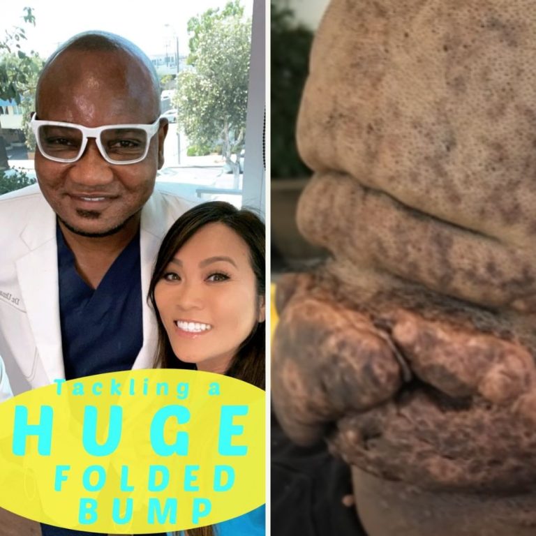 Dr.Pimple Popper Teams Up With Dr.Bumpinator