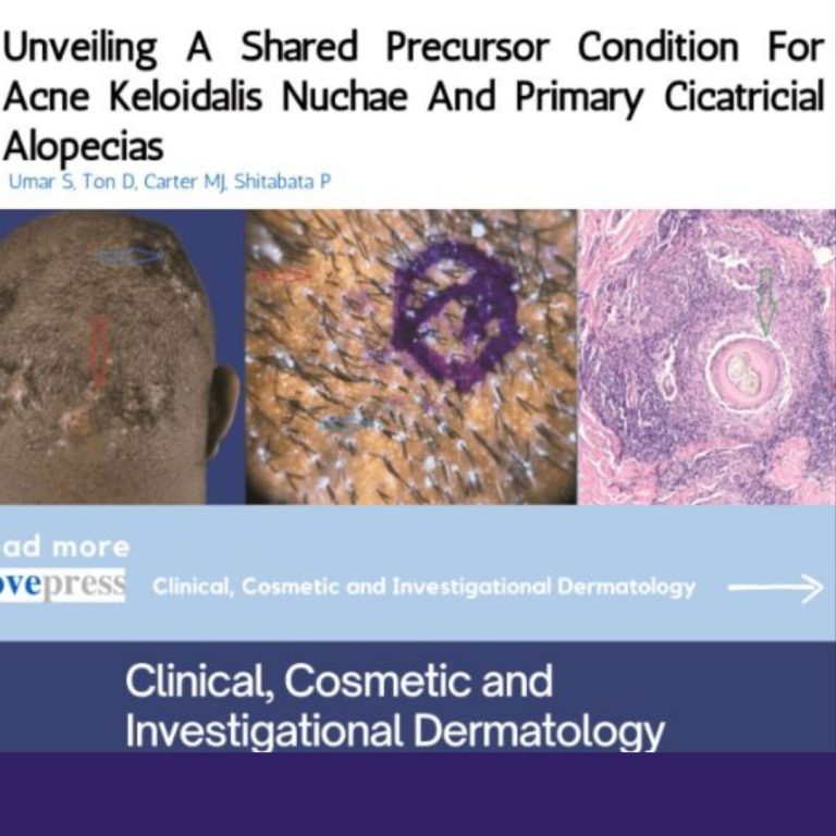 Revealing a Common Precursor Condition in Acne Keloidalis Nuchae and Primary Cicatricial Alopecias