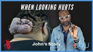From the Cliff’s Edge to Scalp Healing: John’s Transformation