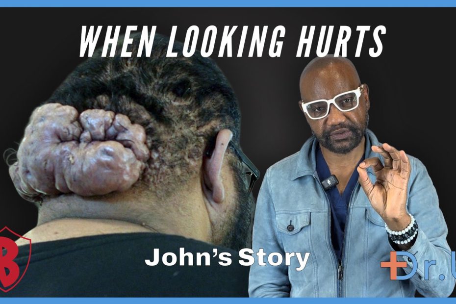 From the Cliff’s Edge to Scalp Healing: John’s Transformation