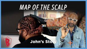 map of the scalp