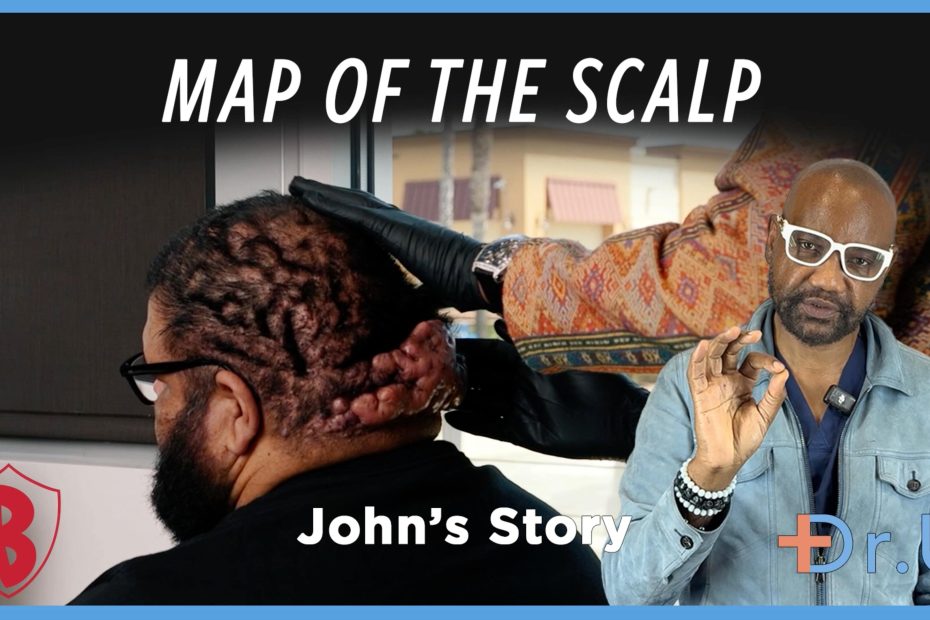 map of the scalp