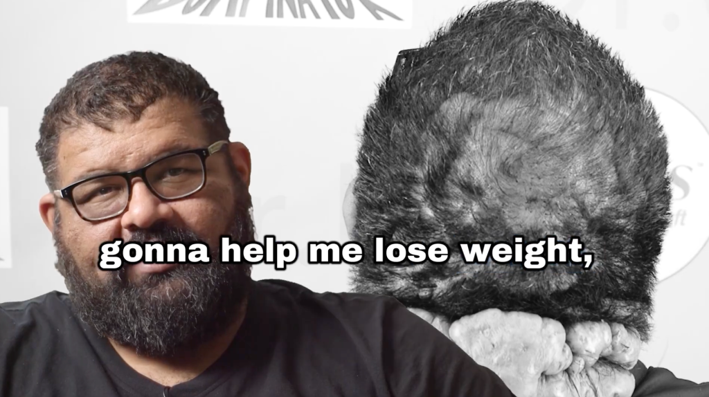 John expressing excitement and amazement when told his treatment would include medical weight support.