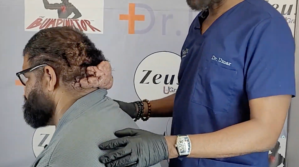 Dr. Sanusi Umar examines John’s scalp while assessing the chronic inflammatory lesions before surgery.