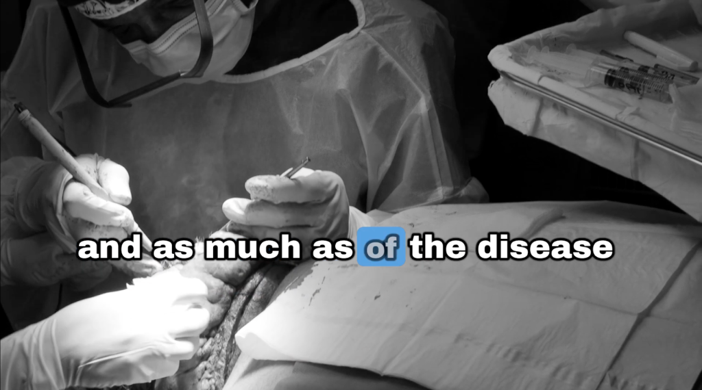 Dr. Sanusi Umar surgically removes diseased scalp tissue affected by multiple inflammatory scalp conditions.