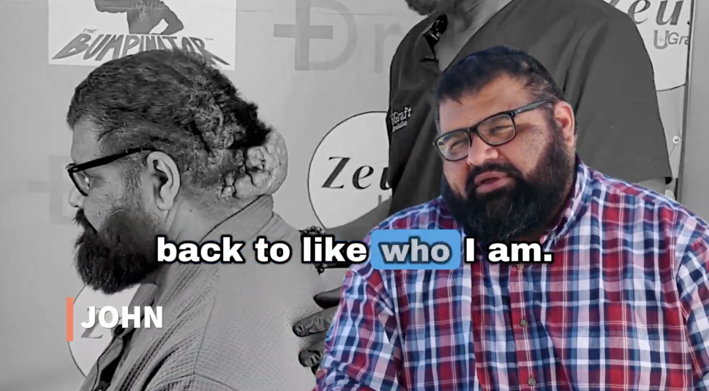 John recovering from scalp surgery reflects on the positive changes he hopes to experience in daily life after treatment.