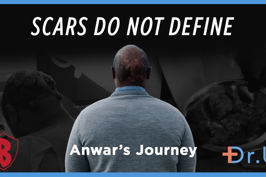 scars do not define