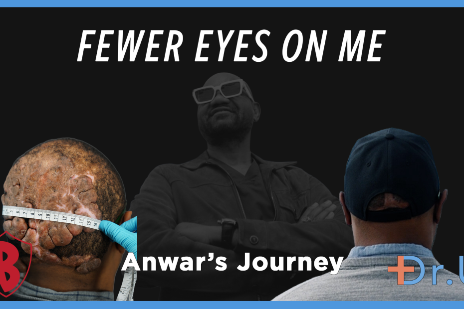 fewer eyes on me