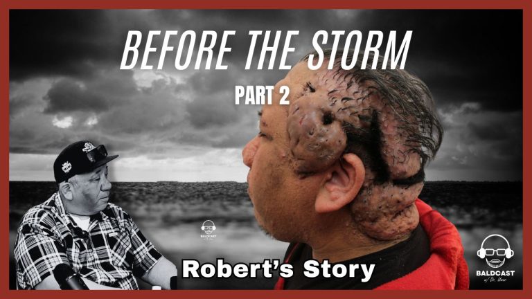 Severe Scalp Disease: Robert’s Life Before and After Treatment