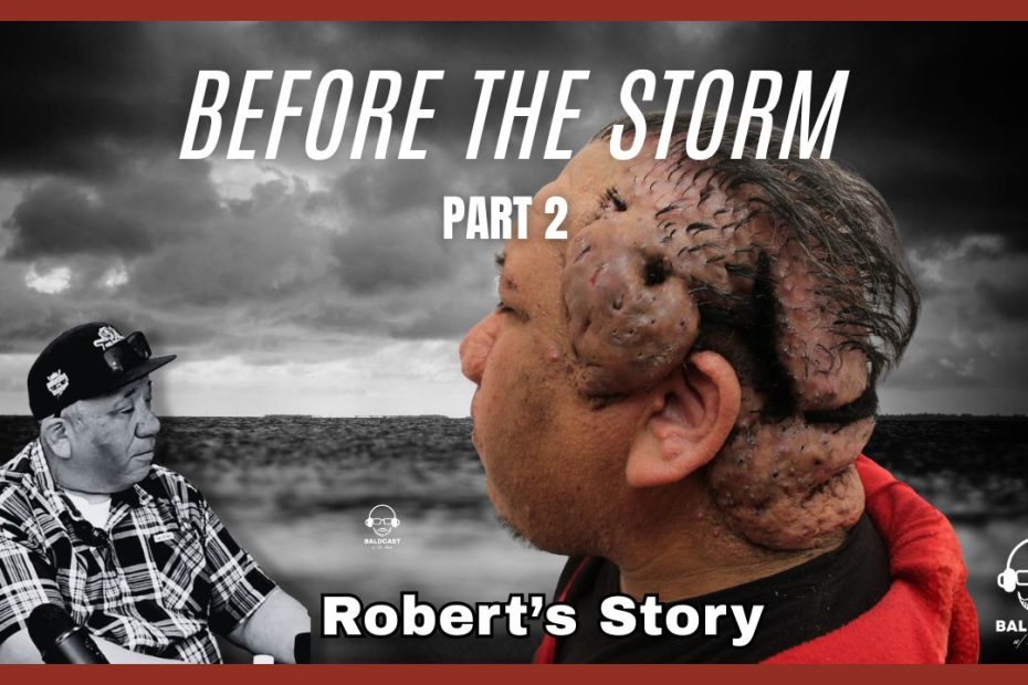 before the storm part 2