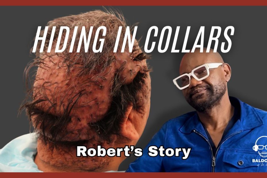 Living With Severe Hairline Bumps: Robert’s Early Coping and Scalp Changes