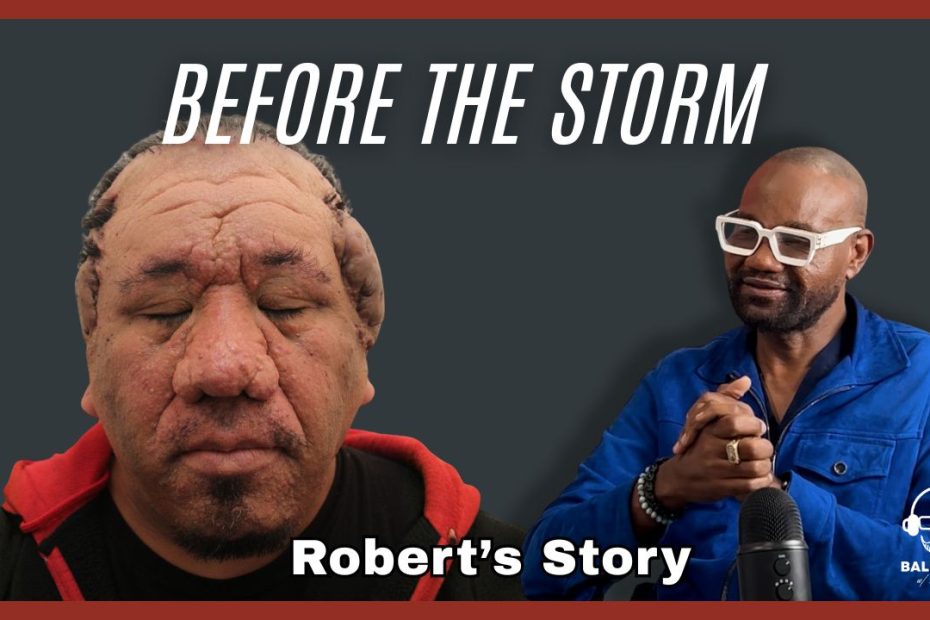 before the storm