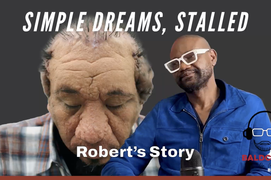 When AKN Began Stealing Robert’s Dreams