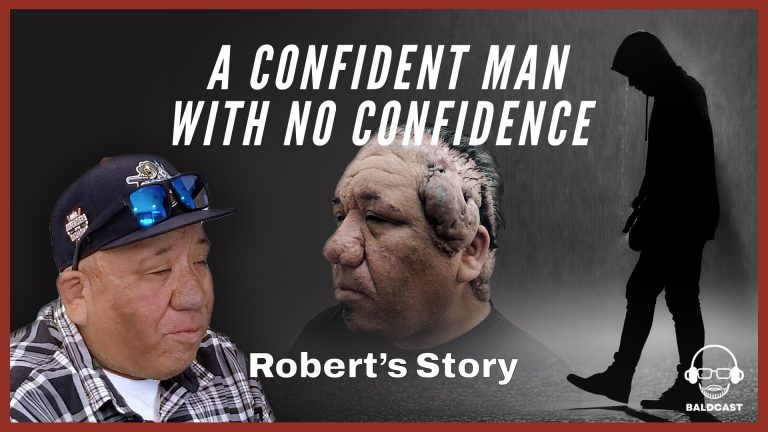 Robert Never Knew Life Without AKN