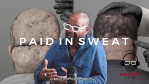 The Cost of Living With Chronic Folliculitis of the Nape | Adrian's Journey