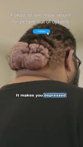 When Looking Hurts The Truth Behind John’s Scalp Bumps