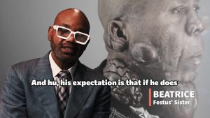 Keloid Recurrence After Surgery: Why Four Procedures Failed andWhat Dr. U Plans Next | Festus Ch- 1