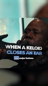Ear Keloid Pushing the Ear Closed (Festus | Chapter 1)