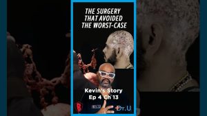 Ep 4 Ch 13: How Kevin Avoided Total Scalp Excision | Dissecting Cellulitis Treatment