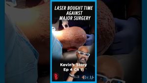 Dissecting Cellulitis: Why Kevin’s Surgery Was Put on Hold
