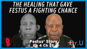Festus’s First Side Healed. What Happens to the Remaining Keloids?