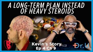 Ep 4 Ch 9: Why Dr. U Limits Heavy Steroids in Scarring Alopecia