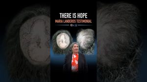 There Is Hope | Maria's Scarring Alopecia Testimonial