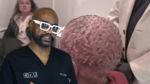 When Treatments Fail: Dissecting Cellulitis and a New Keloid Treatment Approach