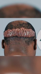 Marcus Is Ready to Say Goodbye to “Mr. Brain” 🧠