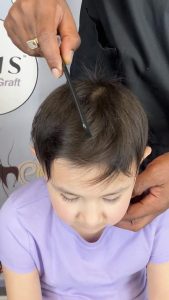 Mia Started Seeing Hair Growth Around Month Four