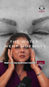 How Eyebrow Loss From Scarring Changes the Way You See Yourself | Maria Chica’s Story