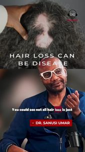 Alopecia Scarring Is Not Vanity: When Treatment Pain Becomes Unbearable | Maria Landeros
