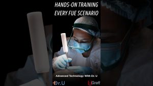 Hands-On Hair Transplant Training: Advanced Technology for Every FUE Scenario