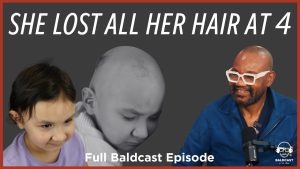 SHE LOST ALL HER HAIR AT 4 | Mia’s Full Baldcast Episode