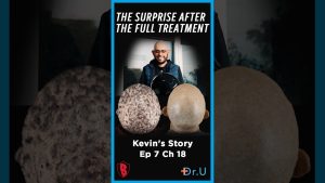 Once Too Painful for a Helmet. Now It’s Part of Kevin’s Daily Routine.