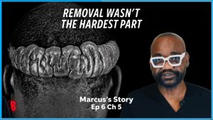 Severe Keloid Removal: Why Surgeons Refuse Treatment