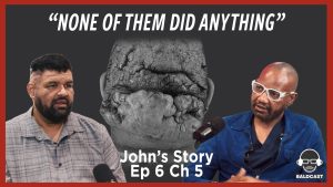 Scalp Bumps on Back of Head: John’s AKN Treatment Story | Baldcast
