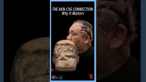 Could New Scalp Folds Be a Warning Sign in AKN?